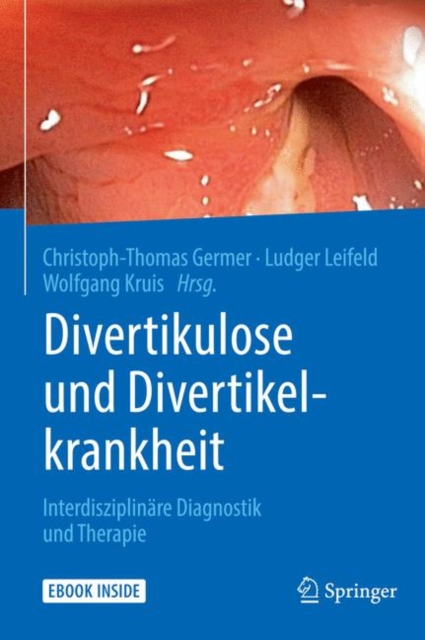 Divertikulose und Divertikelkrankheit : Interdisziplinare Diagnostik und Therapie, EPUB eBook