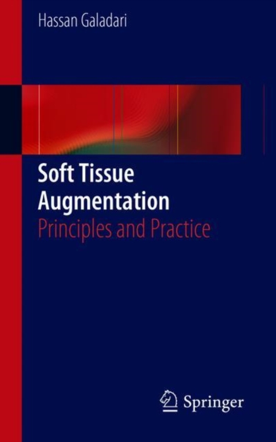 Soft Tissue Augmentation : Principles and Practice, Paperback / softback Book
