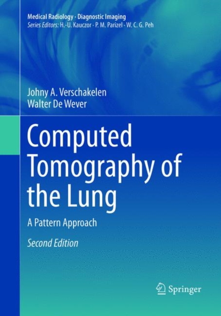 Computed Tomography of the Lung : A Pattern Approach, Paperback / softback Book
