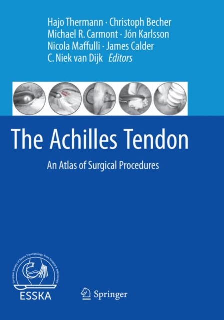 The Achilles Tendon : An Atlas of Surgical Procedures, Paperback / softback Book