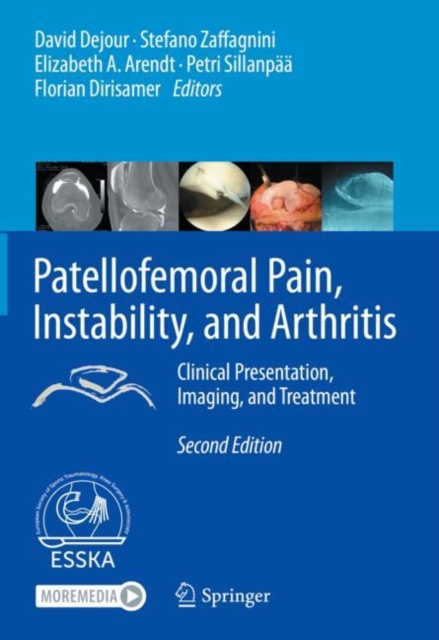 Patellofemoral Pain, Instability, and Arthritis : Clinical Presentation, Imaging, and Treatment, Hardback Book