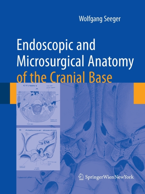 Endoscopic and microsurgical anatomy of the cranial base, Paperback / softback Book