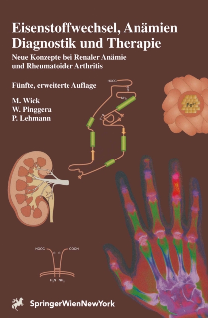 Eisenstoffwechsel, Anamien Diagnostik und Therapie : Neue Konzepte bei Renaler Anamie und Rheumatoider Arthritis, PDF eBook