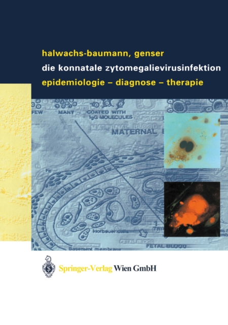 Die konnatale Zytomegalievirusinfektion : Epidemiologie - Diagnose - Therapie, PDF eBook