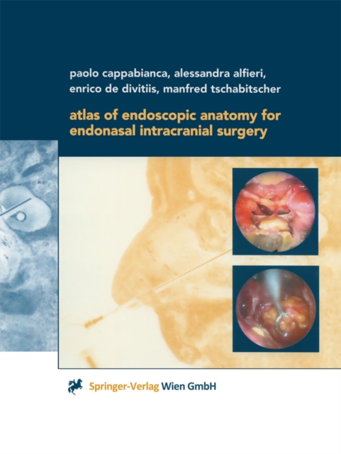 Atlas of Endoscopic Anatomy for Endonasal Intracranial Surgery, PDF eBook