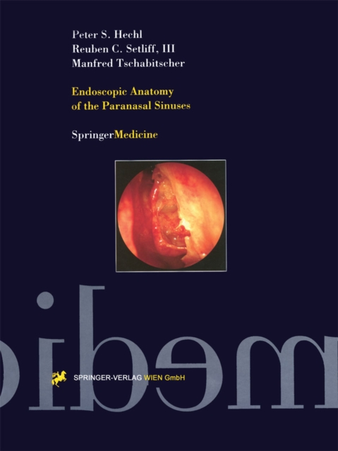 Endoscopic Anatomy of the Paranasal Sinuses, PDF eBook
