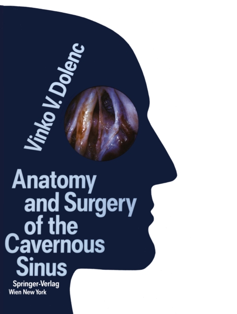 Anatomy and Surgery of the Cavernous Sinus, PDF eBook