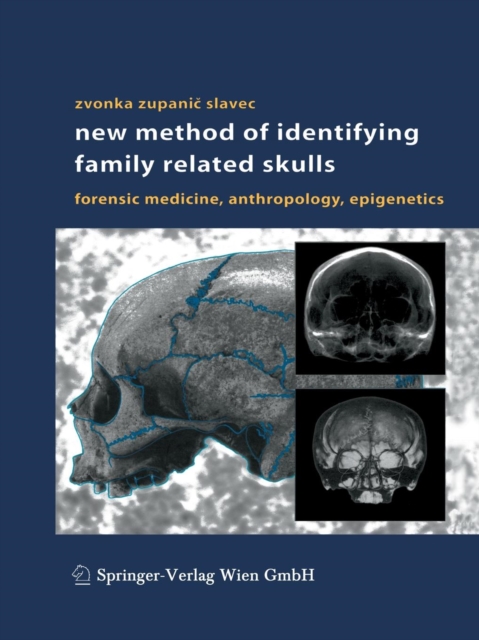 New Method of Identifying Family Related Skulls : Forensic Medicine, Anthropology, Epigenetics, Paperback / softback Book