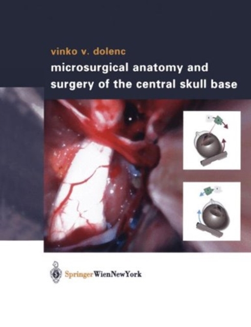 Microsurgical Anatomy and Surgery of the Central Skull Base, Paperback / softback Book