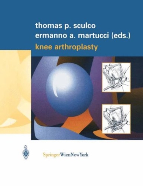 Knee Arthroplasty, Paperback / softback Book