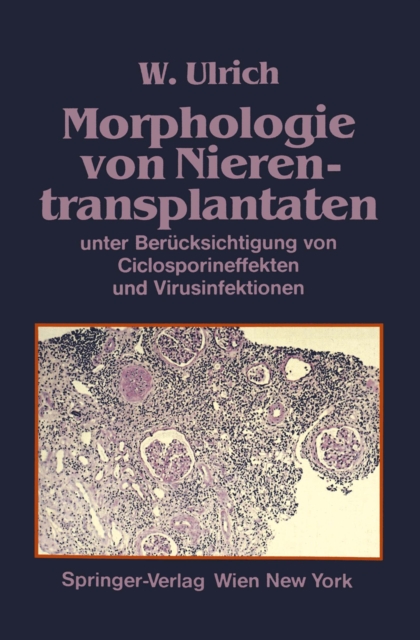 Morphologie von Nierentransplantaten : unter Berucksichtigung von Ciclosporineffekten und Virusinfektionen, PDF eBook