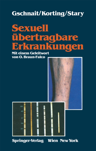 Sexuell ubertragbare Erkrankungen, PDF eBook