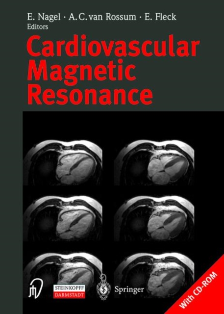 Cardiovascular Magnetic Resonance, Multiple-component retail product Book