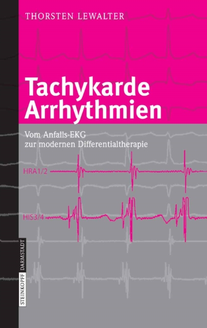 Tachykarde Arrhythmien : Vom Anfalls-EKG zur modernen Differentialtherapie, PDF eBook