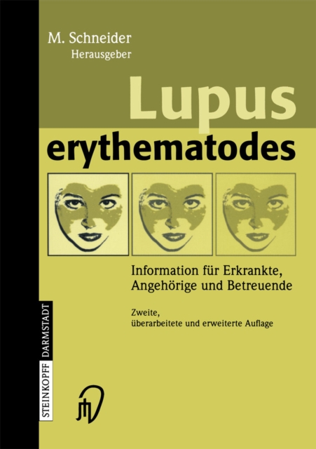 Lupus erythematodes : Information fur Erkrankte, Angehorige und Betreuende, PDF eBook