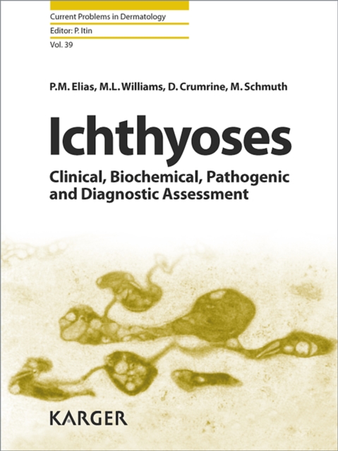 Ichthyoses : Clinical, Biochemical, Pathogenic and Diagnostic Assessment., PDF eBook