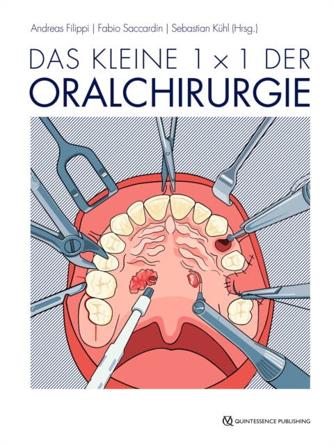 Das kleine 1 x 1 der Oralchirurgie, EPUB eBook