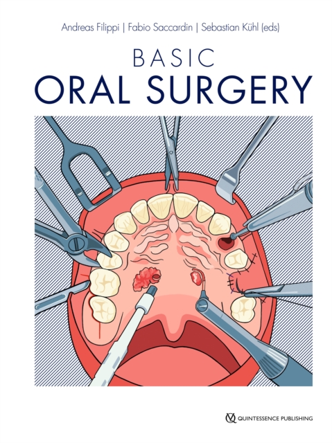 Basic Oral Surgery, EPUB eBook