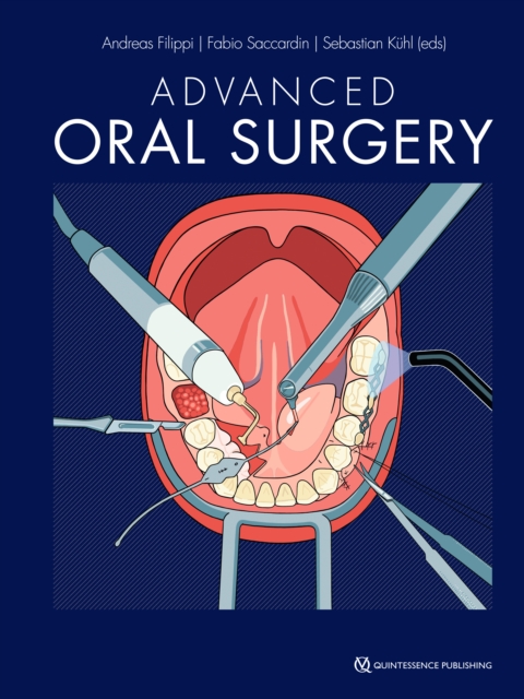 Advanced Oral Surgery, EPUB eBook