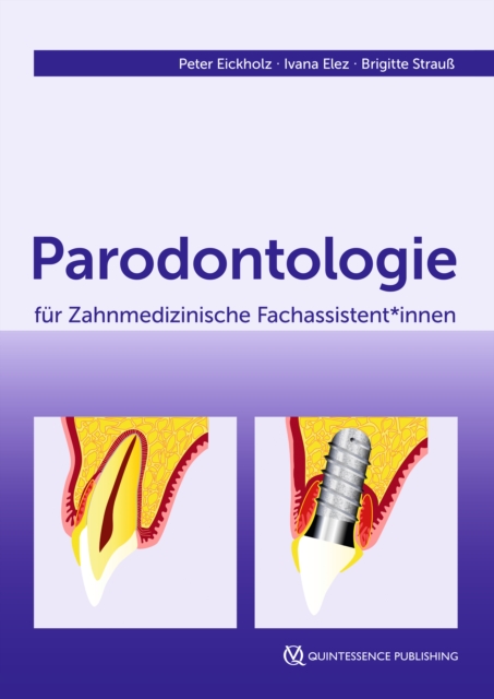 Parodontologie fur Zahnmedizinische Fachassistent*innen, EPUB eBook