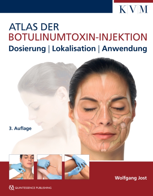 Atlas der Botulinumtoxin-Injektion : Dosierung | Lokalisation | Anwendung, PDF eBook