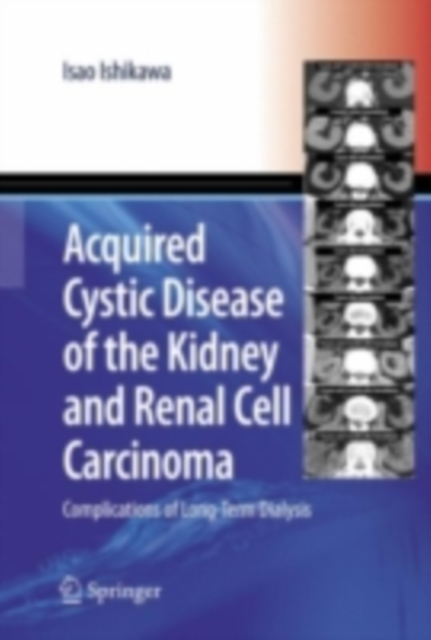 Acquired Cystic Disease of the Kidney and Renal Cell Carcinoma : Complication of Long-Term Dialysis, PDF eBook