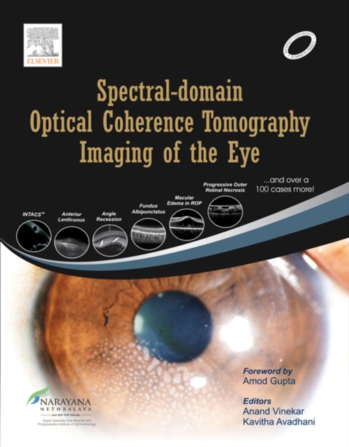 Spectral-domain Optical Coherence Tomography Imaging of the Eye, EPUB eBook