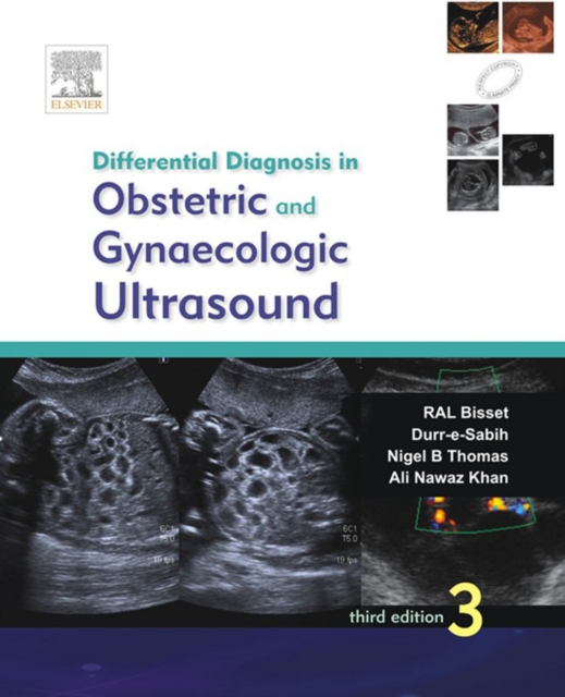 Differential Diagnosis in Obstetrics and Gynecologic Ultrasound - E-Book, EPUB eBook