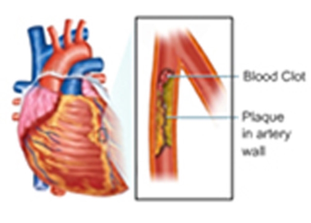 Estimation of Blood Triglycerides, EPUB eBook