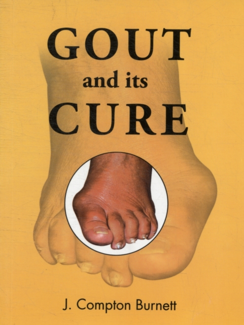 Gout & Its Cure, Paperback / softback Book