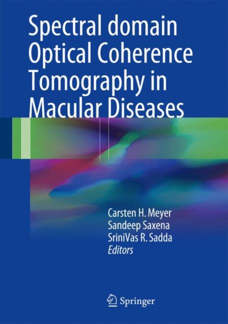 Spectral Domain Optical Coherence Tomography in Macular Diseases, EPUB eBook