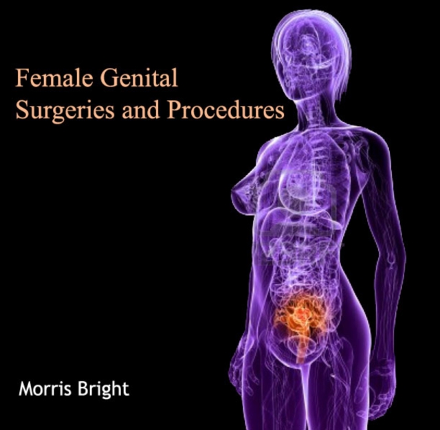 Female Genital Surgeries and Procedures, PDF eBook