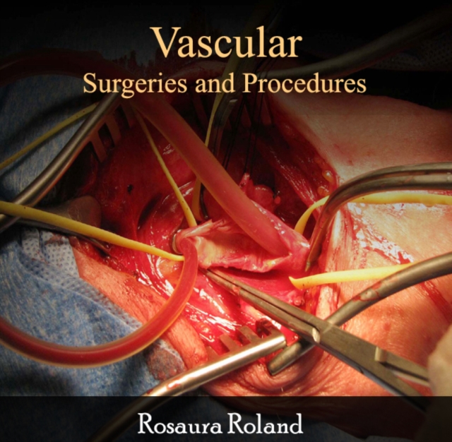 Vascular Surgeries and Procedures, PDF eBook