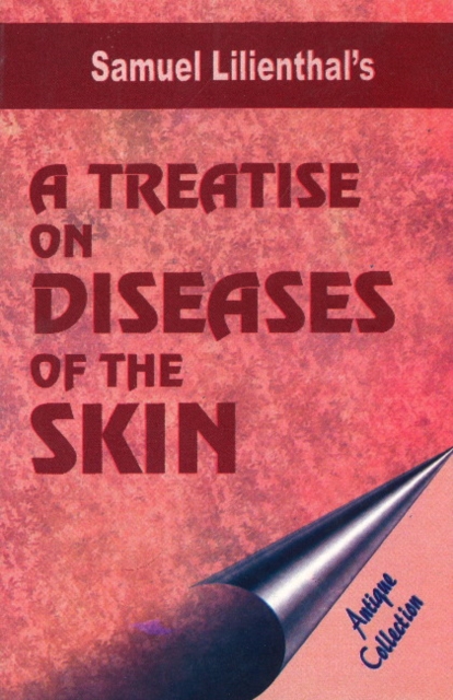 Treatise on Diseases of the Skin : Antique Collection, Paperback / softback Book