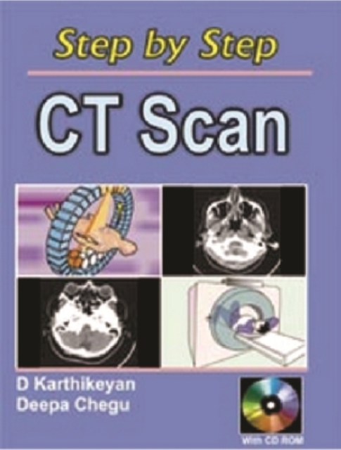 Step by Step CT Scan, Paperback / softback Book