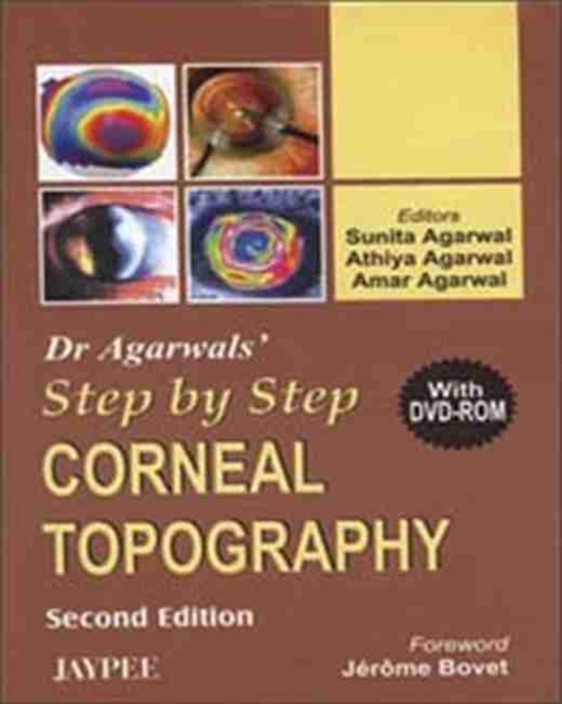 Dr Agarwal's Step by Step (R) Corneal Topography, Paperback / softback Book