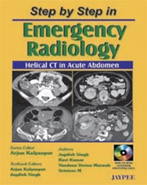 Step by Step in Emergency Radiology: Helical CT in Acute Abdomen, Paperback / softback Book