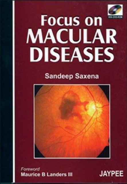 Focus on Macular Diseases, Mixed media product Book