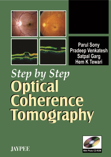 Step by Step: Optical Coherence Tomography, Mixed media product Book