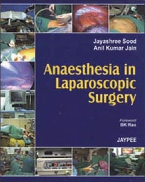 Anaesthesia in Laparoscopic Surgery, Hardback Book