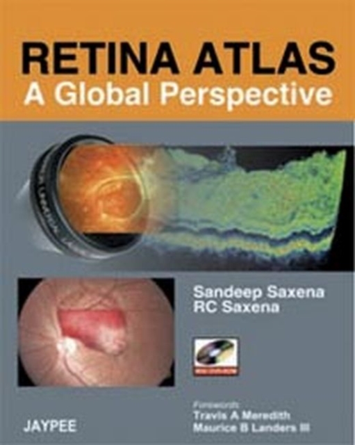 Retina Atlas - A Global Perspective, Multiple-component retail product Book
