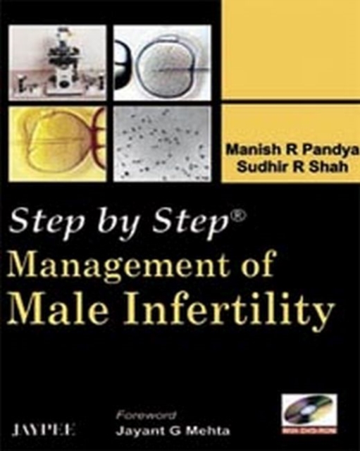 Step by Step: Management of Male Infertility, Paperback / softback Book