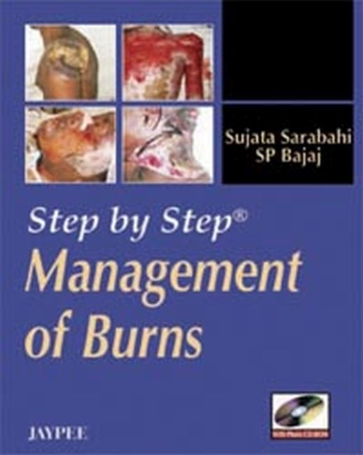 Step by Step: Management of Burns, Multiple-component retail product Book