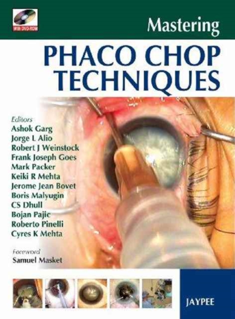 Mastering Phaco Chop Techniques, Mixed media product Book