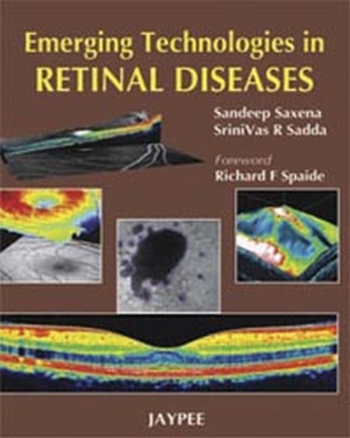 Emerging Technologies in Retinal Disease, Hardback Book