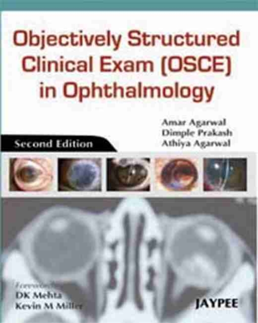 Objectively Structured Clinical Exam (OSCE) in Ophthalmology, Paperback / softback Book