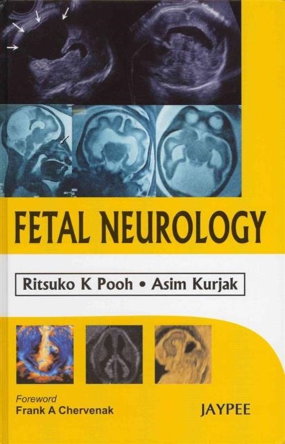 Fetal Neurology, Hardback Book