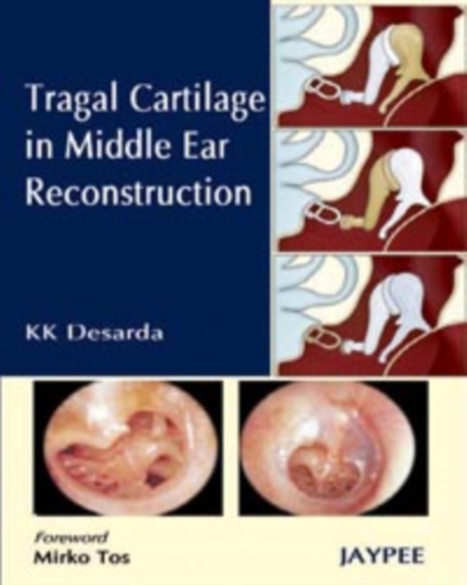 Tragal Cartilage in Middle Ear Reconstruction, Hardback Book