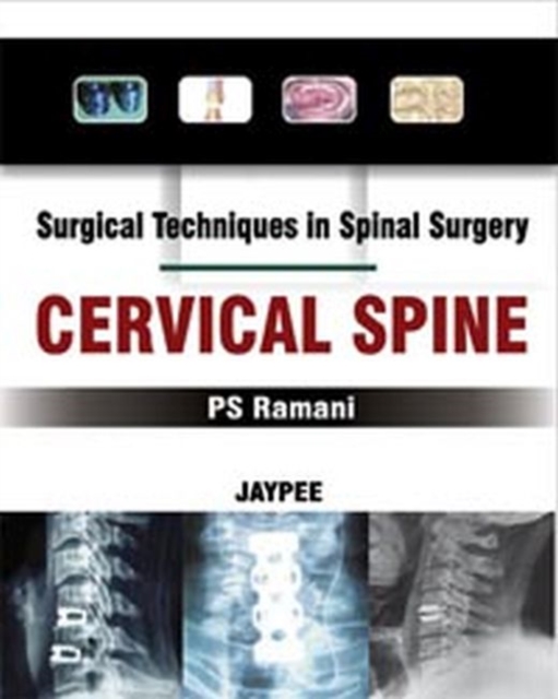 Surgical Techniques in Spinal Surgery: Cervical Spine, Hardback Book