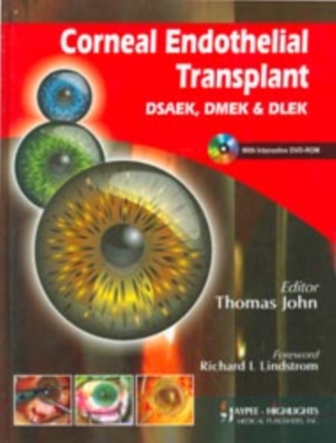 Corneal Endothelial Transplant DSEAK, DMEK and DLEK, Mixed media product Book